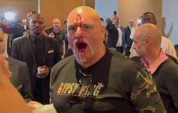 Furys Vater schlug seinen Kopf während eines Handgemenges mit Usiks Team blutig (Video)